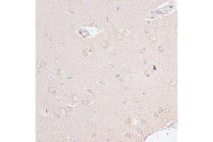 Immunohistochemistry of paraffin-embedded rat brain using ABCF2 antibody. (ABCF2 antibody  (AA 1-250))