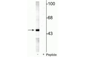Western blot of rat testes lysate showing specific labeling of the ~49 kDa MEK5 protein phosphorylated at Ser311 Thr315 in the first lane (-). (MAP2K5 antibody  (pSer311, pThr315))