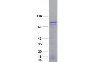 Validation with Western Blot (ALKBH8 Protein (Myc-DYKDDDDK Tag))