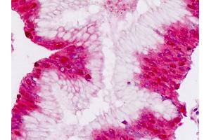 Human Pancreas: Formalin-Fixed, Paraffin-Embedded (FFPE) (P-Cadherin antibody  (AA 114-142))