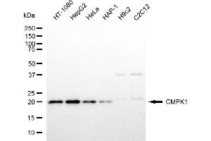 Western blotting analysis using CMPK1 antibody (ABIN7798241).