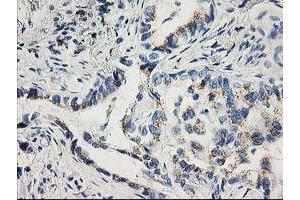 Image no. 5 for anti-Cyclin-Dependent Kinase 2 (CDK2) antibody (ABIN1497394) (CDK2 antibody)