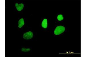 Immunofluorescence of purified MaxPab antibody to XRCC1 on HeLa cell. (XRCC1 antibody  (AA 1-633))