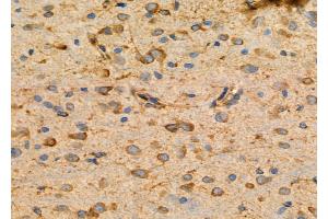 ABIN6264935 and ABIN6276742 at 1/100 staining Rat brain tissue by IHC-P.