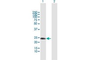 IFNA8 antibody  (AA 1-189)