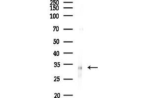 anti-Melanocortin 1 Receptor (MC1R) (C-Term) antibody