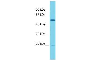 Host: Rabbit  Target Name: Elf2  Sample Tissue: Rat Thymus lysates  Antibody Dilution: 1. (ELF2 antibody  (Middle Region))