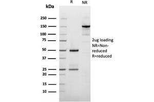 SDS-PAGE Analysis Purified Filaggrin Mouse Recombinant Monoclonal Antibody (rFLG/1561). (Recombinant Filaggrin antibody  (AA 198-288))