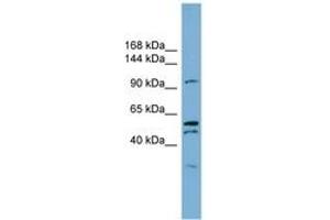 Image no. 1 for anti-Anoctamin 6 (ANO6) (AA 791-840) antibody (ABIN6743329) (Anoctamin 6 antibody  (AA 791-840))