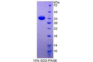 SDS-PAGE (SDS) image for Renin Binding Protein (RENBP) (AA 1-254) protein (His tag) (ABIN2126662) (RENBP Protein (AA 1-254) (His tag))