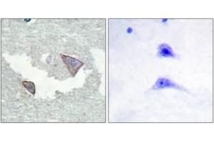 Immunohistochemistry analysis of paraffin-embedded human brain, using PDGFR alpha (Phospho-Tyr754) Antibody. (PDGFRA antibody  (pTyr754))