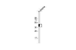 Anti-HPR Antibody (Center) at 1:2000 dilution + human plasma lysate Lysates/proteins at 20 μg per lane.