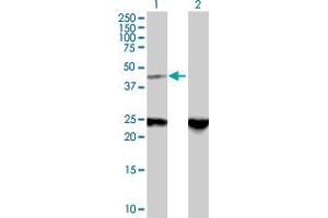 Western Blot analysis of ZNF24 expression in transfected 293T cell line by ZNF24 MaxPab polyclonal antibody. (ZNF24 antibody  (AA 1-368))