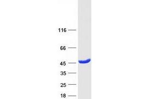 Validation with Western Blot (GMPR2 Protein (Transcript Variant 3) (Myc-DYKDDDDK Tag))