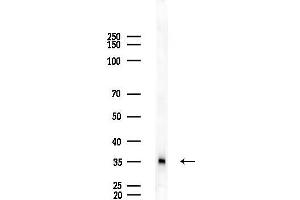anti-Adaptor-Related Protein Complex 1 Associated Regulatory Protein (AP1AR) antibody