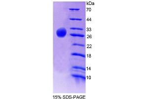 SDS-PAGE (SDS) image for Guanine Nucleotide Binding Protein (G Protein), alpha Z Polypeptide (GNaZ) (AA 2-219) protein (His tag) (ABIN6239060) (GNaZ Protein (AA 2-219) (His tag))