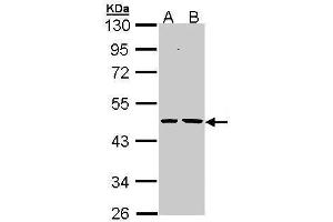 WB Image Sample (30 ug of whole cell lysate) A: H1299 B: Hela 10% SDS PAGE antibody diluted at 1:1000 (EPHX1 antibody)