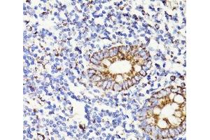 Immunohistochemistry of paraffin-embedded Human appendix using PDCD10 Polyclonal Antibody at dilution of 1:100 (40x lens). (PDCD10 antibody)