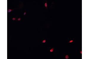 ABIN6266753 staining HeLa  cells by IF/ICC. (MUTYH antibody  (Internal Region))