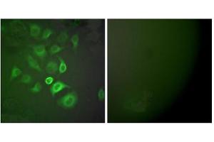 Immunofluorescence analysis of A549 cells, using S100 A1 antibody (ABIN5976502). (S100A1 antibody  (N-Term))