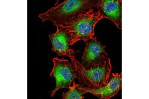 Immunocytochemistry (ICC) image for anti-3-phosphoinositide Dependent Protein Kinase-1 (PDPK1) (AA 457-556) antibody (ABIN5855659) (PDPK1 antibody  (AA 457-556))