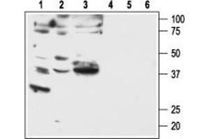 Western blot analysis of human breast adenocarcinoma MDA-MB-231 (lanes 1 and 4) and MDA-MB-468 (lanes 2 and 5), and human lung small cell carcinoma NCI-H526 (lanes 3 and 6) cell lines: - 1-3. (F2RL1 antibody  (C-Term, Intracellular))
