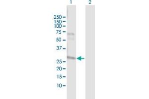 Western Blot analysis of NAT2 expression in transfected 293T cell line by NAT2 MaxPab polyclonal antibody. (NAT2 antibody  (AA 1-290))