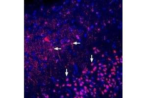 Immunohistochemistry (IHC) image for anti-Adenosine A2a Receptor (ADORA2A) (AA 143-156), (Extracellular) antibody (ABIN7042886)