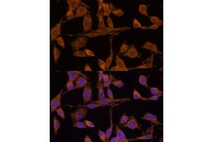 Immunofluorescence analysis of HeLa cells using USP15 Polyclonal Antibody (ABIN6130759, ABIN6149998, ABIN6149999 and ABIN6222530) at dilution of 1:100 (40x lens). (USP15 antibody  (AA 852-952))