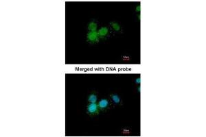 ICC/IF Image Immunofluorescence analysis of paraformaldehyde-fixed A549, using Progesterone receptor, antibody at 1:200 dilution. (Progesterone Receptor antibody  (N-Term))