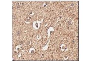 Immunohistochemistry (Paraffin-embedded Sections) (IHC (p)) image for anti-Autophagy Related 12 (ATG12) (Middle Region) antibody (ABIN497964)