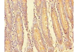 Immunohistochemistry of paraffin-embedded human small intestine tissue using ABIN7169145 at dilution of 1:100 (PIM2 antibody  (AA 1-210))