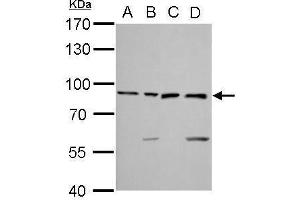 WB Image Ku80 antibody [N3C2], Internal detects XRCC5 protein by Western blot analysis. (X-Ray Repair Cross Complementing 5 antibody)