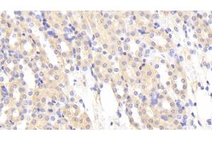 Detection of MASP1 in Mouse Kidney Tissue using Polyclonal Antibody to Mannose Associated Serine Protease 1 (MASP1) (MASP1 antibody  (AA 25-453))