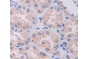 Figure. (SPR antibody  (AA 1-261))