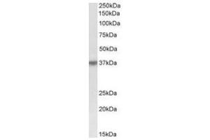 Antibody (0. (HSH2D antibody  (Internal Region))