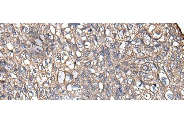 KRT73 antibody