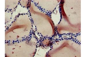 Immunohistochemistry of paraffin-embedded human thyroid tissue using ABIN7167100 at dilution of 1:100 (RBCK1 antibody  (AA 162-261))