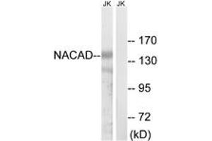 Western blot analysis of extracts from Jurkat cells, using NACAD Antibody. (NACAD antibody  (AA 376-425))