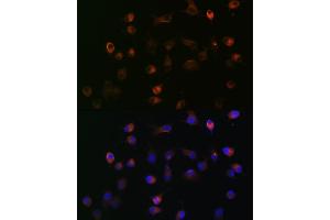 Immunofluorescence analysis of HeLa cells using γ-Catenin Rabbit mAb (ABIN1683043, ABIN3018625, ABIN3018626 and ABIN7101634) at dilution of 1:100 (40x lens). (JUP antibody)