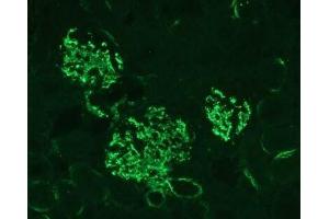 C3 protein fragments deposited on kidney cells of MPL-lpr mouse. (C3 antibody)
