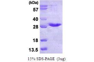 SDS-PAGE (SDS) image for NFKB Inhibitor Interacting Ras-Like 1 (NKIRAS1) (AA 1-192) protein (His tag) (ABIN6386901) (NKIRAS1 Protein (AA 1-192) (His tag))