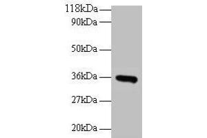Western blot All lanes: CYC1 antibody at 2 μg/mL + EC109 whole cell lysate Secondary Goat polyclonal to rabbit IgG at 1/15000 dilution Predicted band size: 36 kDa Observed band size: 36 kDa (Cytochrome C1 antibody  (AA 85-325))