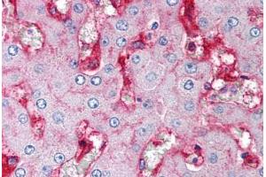 Human Liver (formalin-fixed, paraffin-embedded) stained with B2M antibody ABIN239806 at 5 ug/ml followed by biotinylated anti-mouse IgG secondary antibody ABIN481714, alkaline phosphatase-streptavidin and chromogen. (beta-2 Microglobulin antibody)