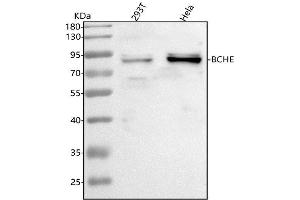 Western blot analysis of BCHE using anti-BCHE antibody (ABIN7601143).