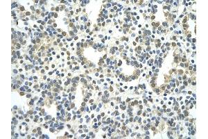 Immunohistochemistry (IHC) image for anti-Nuclear Receptor Subfamily 2, Group F, Member 2 (NR2F2) (N-Term) antibody (ABIN2792599)