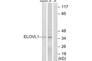 Western blot analysis of extracts from HepG2 cells and Jurkat cells, using ELOVL1 antibody. (ELOVL1 antibody  (Internal Region))