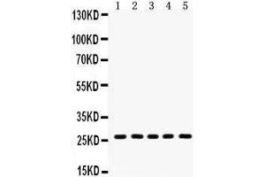 Western Blotting (WB) image for anti-Hydroxysteroid (17-Beta) Dehydrogenase 10 (HSD17B10) (AA 48-261) antibody (ABIN3042460) (HSD17B10 antibody  (AA 48-261))