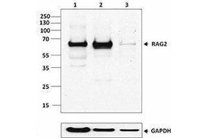 Western Blotting (WB) image for anti-Recombination Activating Gene 2 (RAG2) antibody (ABIN2666293) (RAG2 antibody)
