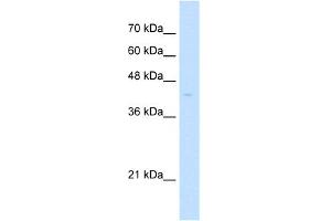 WB Suggested Anti-PHF6 Antibody Titration:  5.